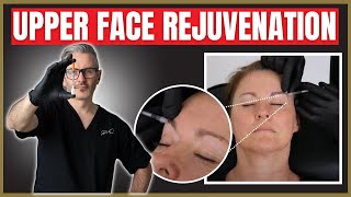 Upper Face Injection techniques | Botox & Filler Periorbital Rejuvenation Tutorial