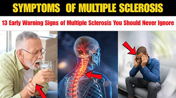 13 Early Warning Signs of Multiple Sclerosis You Shouldn’t Ignore (MS Symptoms Explained)