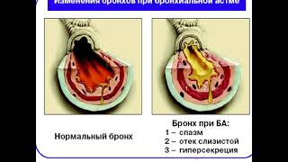 Бронхиты у животных ВНБ Сарсенбаев Т Т