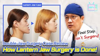 [EN/JP/TH/ SUB] Korean Double Jaw Surgery Case Review: Lantern Jaw