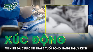 Xúc động câu chuyện mẹ hiến da cứu con trai 2 tuổi bỏng nặng nguy kịch | SKĐS