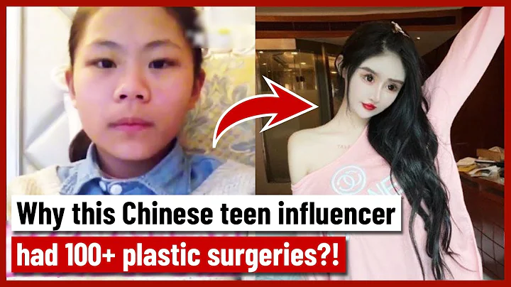 Why this Chinese teen influencer had 100+ plastic surgeries?! - DayDayNews
