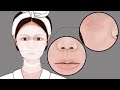 Ordinary skincare routines for dry flaky skin丨Meng&#39;s Stop Motion