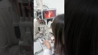 Slit lamp with camera #ophthalmology #eyecare #optometrist #optometry #slitlamp #eyes #ophthalmic