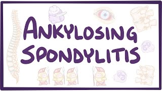 Ankylosing spondylitis  causes, symptoms, diagnosis, treatment, pathology