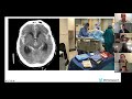 Medical student lecture series  neurocritical care