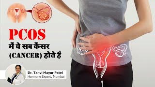 क्या PCOS से कैंसर होता है? PCOS and Cancer