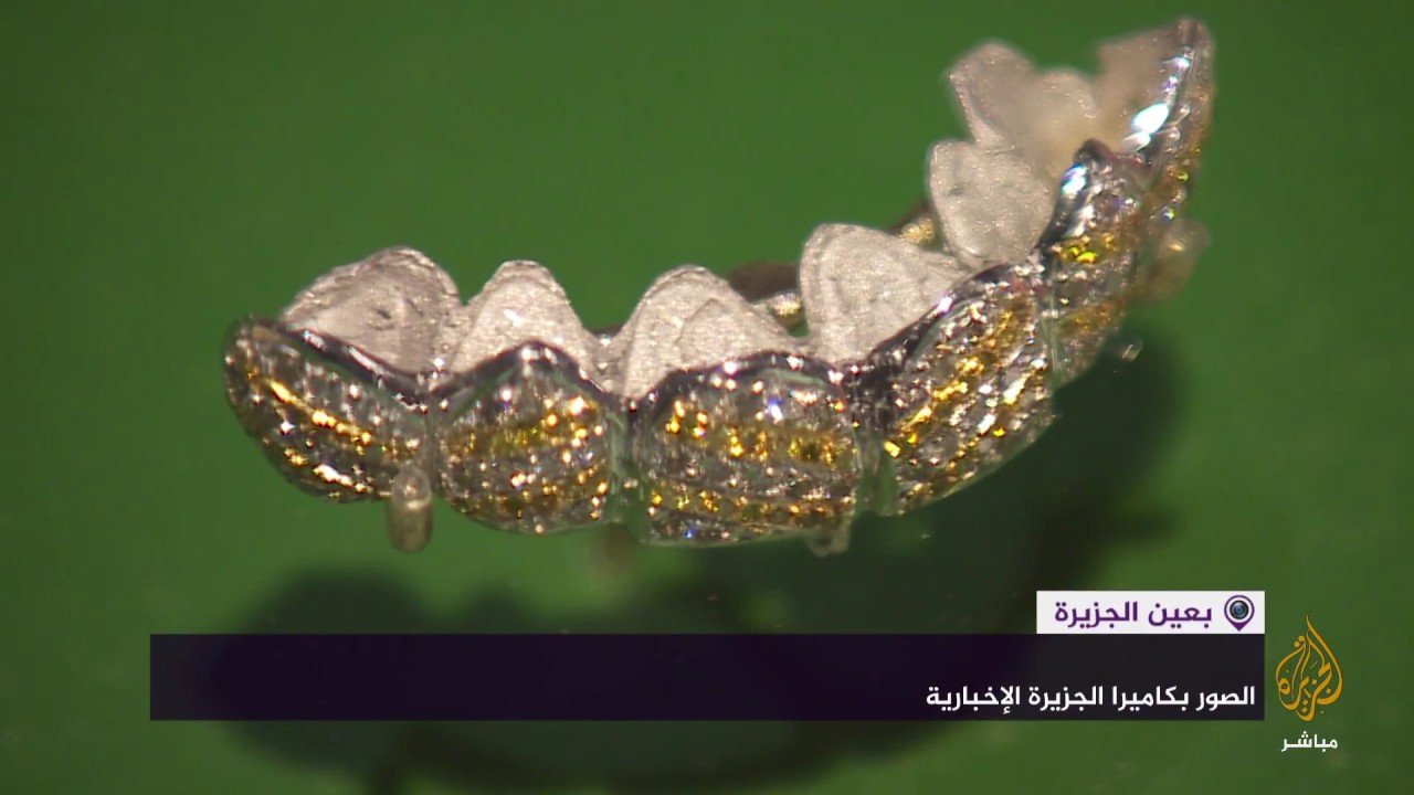 معرض في لندن يسرد تاريخ جراحة الأسنان على مدى عصور