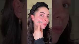 🧪Acne Map Secrets What Breakouts REALLY Mean#acneproneskin
