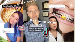 Braces Tips/Life Hacks