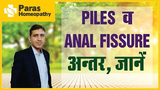 Piles And Anal Fissure Difference | पाइल्स और फिस्सुरे में अन्तर| | Hemorrhoid Fissure | Bawaseer