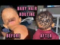 BABY HAIR ROUTINE  | GROW BACK BALDING & NO MORE ECZEMA!