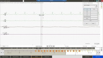 Patient Monitoring PIC iX C 03 Creating a Saved Strip