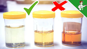 Welche Urinfarbe ist gefährlich?