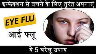 Eye Flu (Conjunctivitis) को कैसे ठीक करें Eye flu Home Remedies I घरेलू उपचार eyeflu treatment
