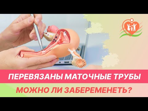 💁‍♀️ Перевязаны маточные трубы - можно ли забеременеть?