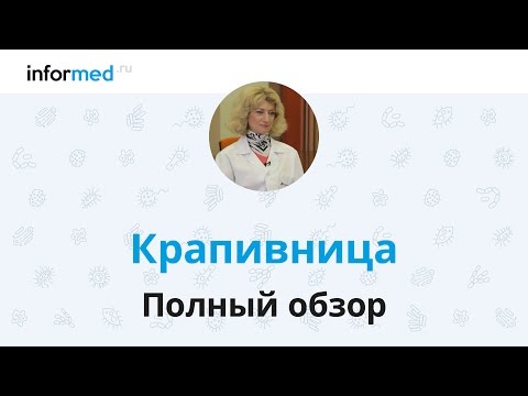 Крапивница: обзор, симптомы, диагностика, лечение, профилактика.