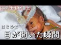 【23週で生まれた双子】はじめて目が開いた瞬間が尊い【超低出生体重児】
