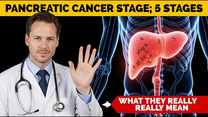 Pancreatic Cancer Stages: What They Really Mean