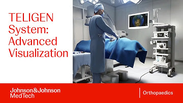 TELIGEN System Overview: Visualization and Control in Spine Surgery | DePuy Synthes