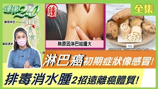 斯卡羅男星罹 淋巴癌 辭世 初期症狀像感冒 留意6大症狀 2招遠離癌體質 健康2.0 20210828 (完整版)