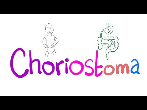 Videó: Mi a különbség a hamartoma és a choristoma között?