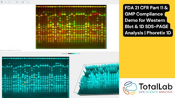 FDA 21 CFR Part 11 & GMP Compliance Demo for Western Blot & 1D SDS-PAGE Analysis | Phoretix 1D
