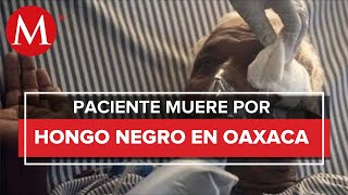 En Oaxaca, murió uno de los dos pacientes con posible hongo negro’
