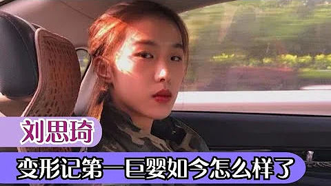 劉思琦：變形記第一巨嬰，16歲需要別人喂飯，開蘭博基尼體驗生活【網紅名人榜】 - 天天要聞