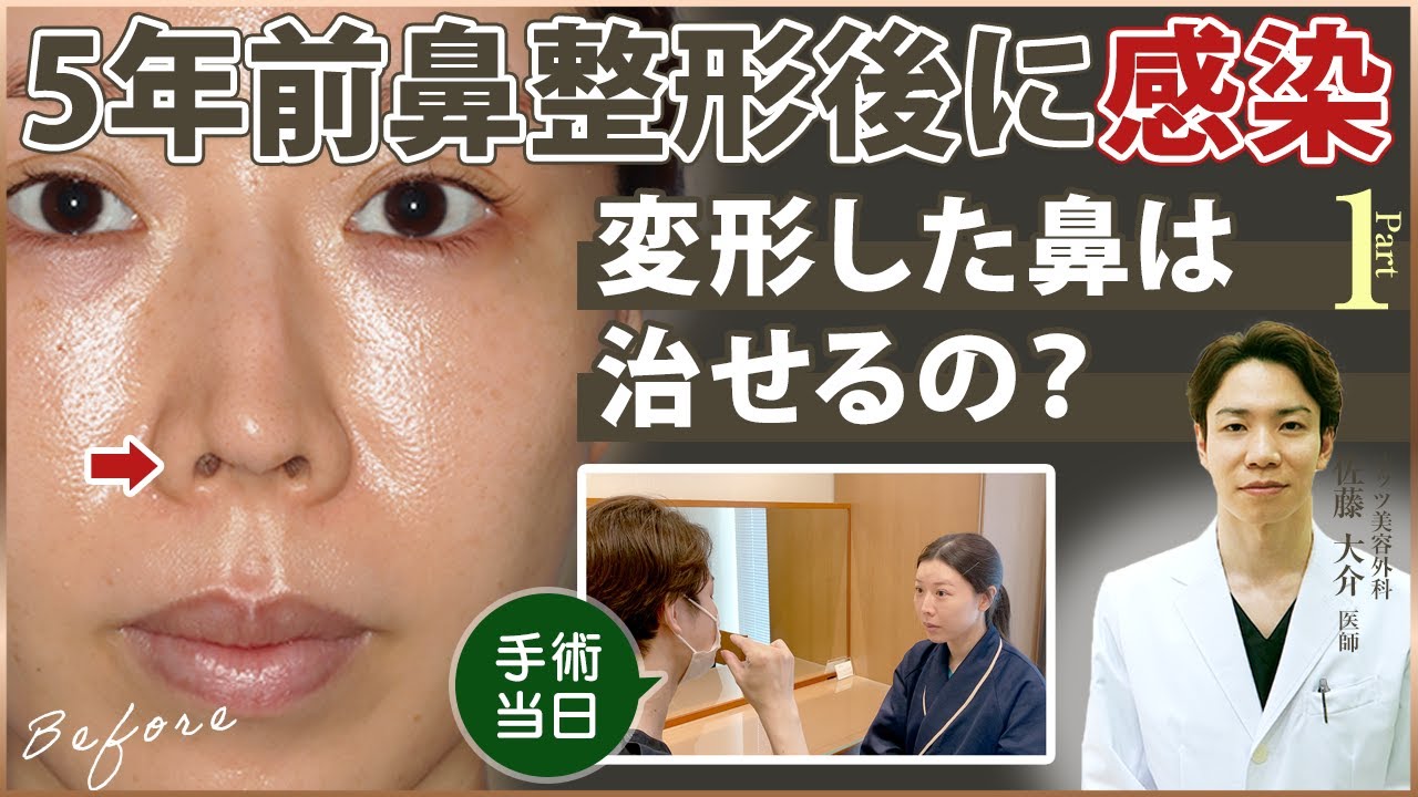 Cosmetic surgery for a woman in her 30s] A patient came to our