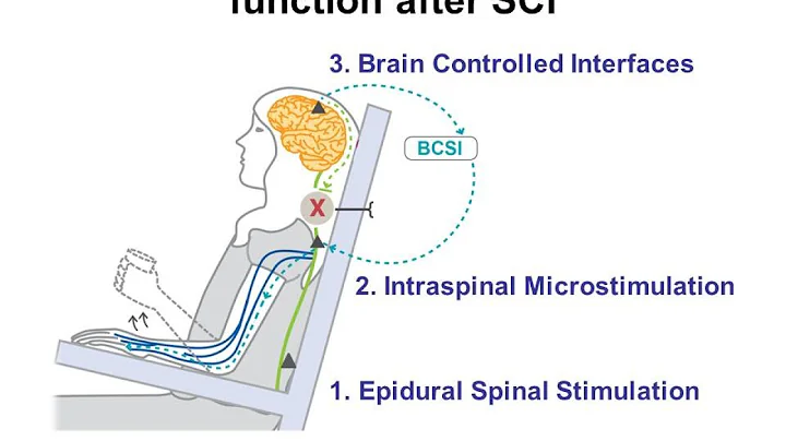Restoring function after spinal cord injury: New research in neural stimulation
