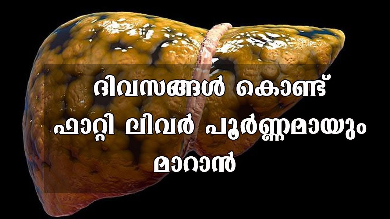 Ways to get rid of Fatty liver YouTube