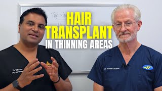 Managing Hair Transplant in Thinning Areas