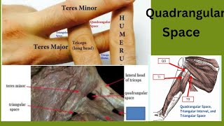 Famous What is quadrangular space ? Where is  quadrangular space ? Wealth