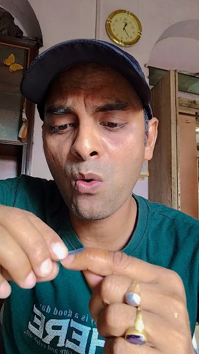 Sick hangnail(full version)🥴😲#shorts😅