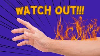 Arm on fire