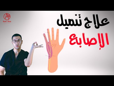 فيديو: 3 طرق لعلاج الخدر في اليدين