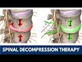 Neck, Back, and Sciatica Pain Relief with Spinal Decompression Therapy | St. Joseph, MI