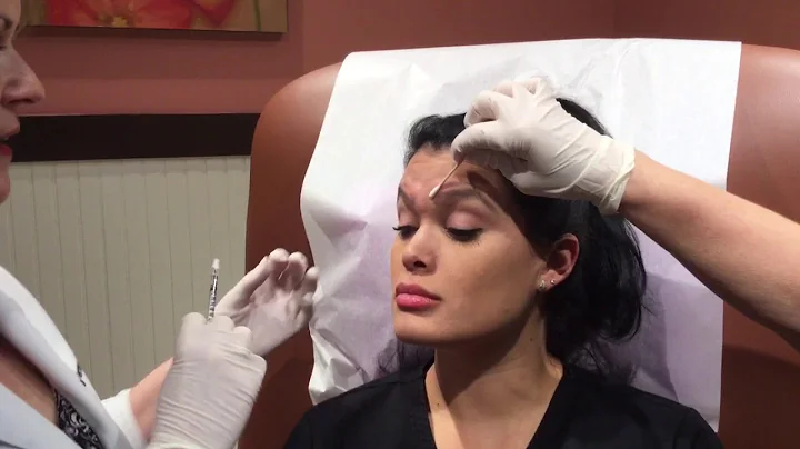 Watch Dr. Banta perform a Botox treatment