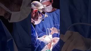 Transgender Surgeries- FFF,SRS
