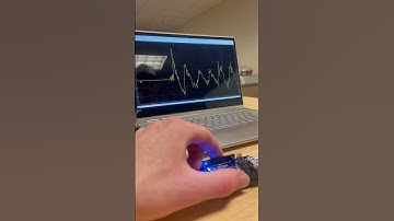 Arduino Mega2560 Gyroscope Demonstration about Lateral Axis