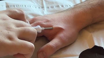 Biohacking at Defcon 2023 - Defcon 31 NFC/RFID Injection