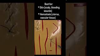 Continuous Interlocking Sutures | Suture Like Surgeon