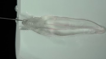 Endodontic apical preparation