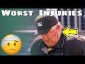 MLB | Interesting Injuries Super Cut
