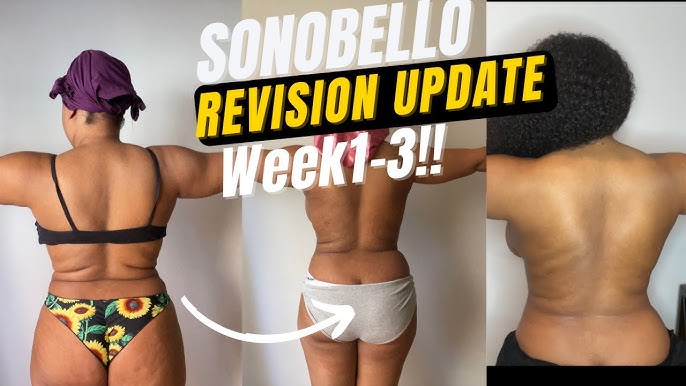 Week 16 SonoBello Body Update !What Happens when you STOP wearing