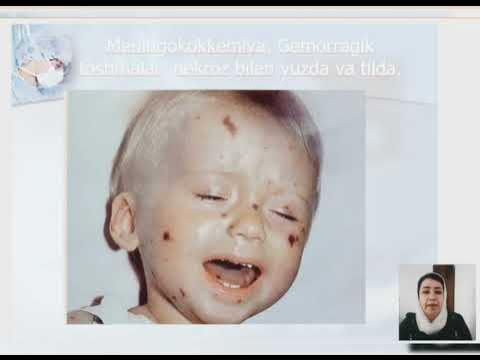 Onlaynda yutish bilan boshashmasdan tomosha qiling