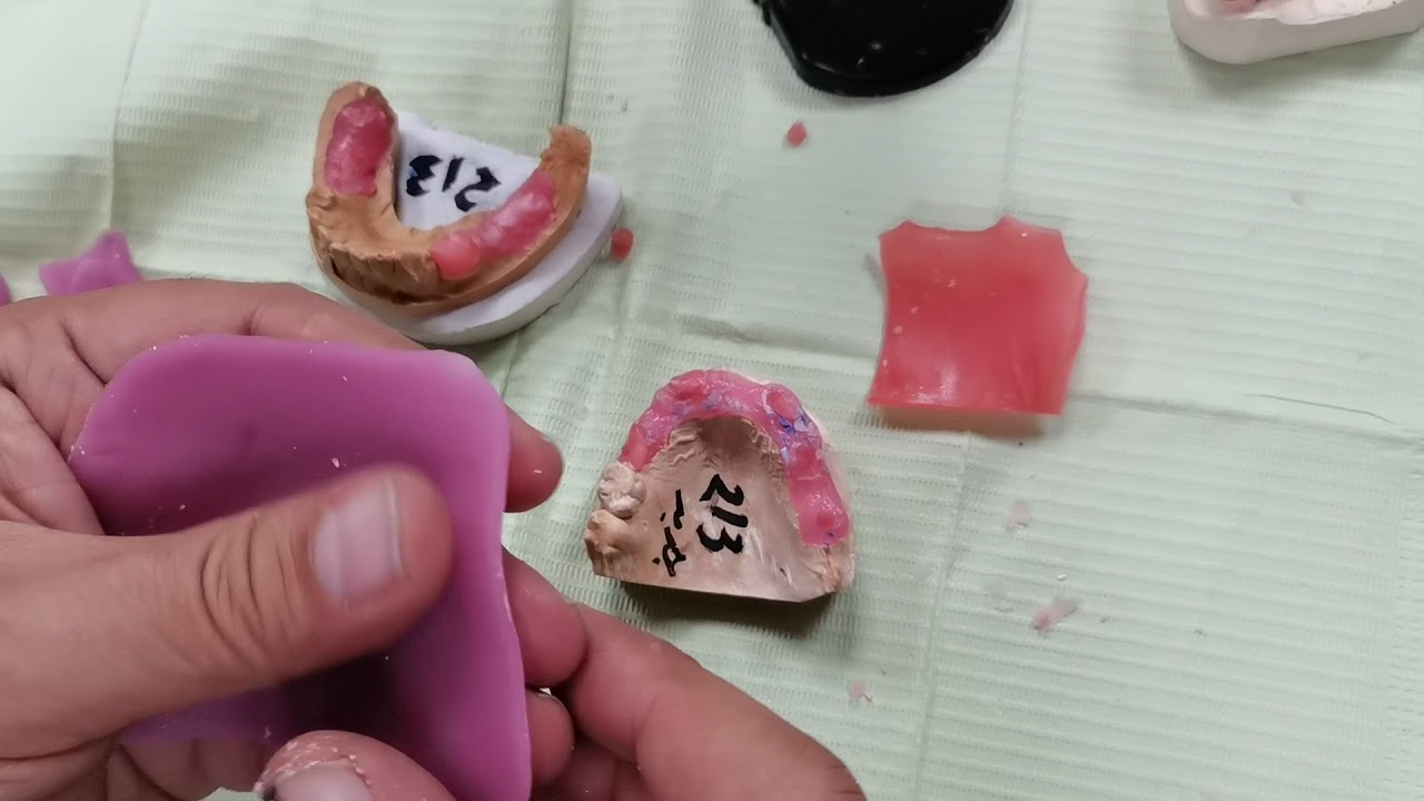 كثير من الطلبة يعتقدون ان صناعة الأسنان تخص المختبر وهذا أمر خاطئ، فهو يدخل بكل مجالات طب الأسنان