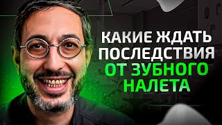 Последствия ЗУБНОГО НАЛЕТА, о которых вы не подозревали… Как он появляется и что происходит дальше?