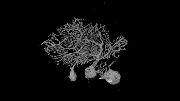 Knife-Edge Scanning Microscope (KESM): Cerebellar Purkinje cells